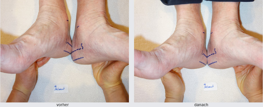 Geistig energetische Begradigung